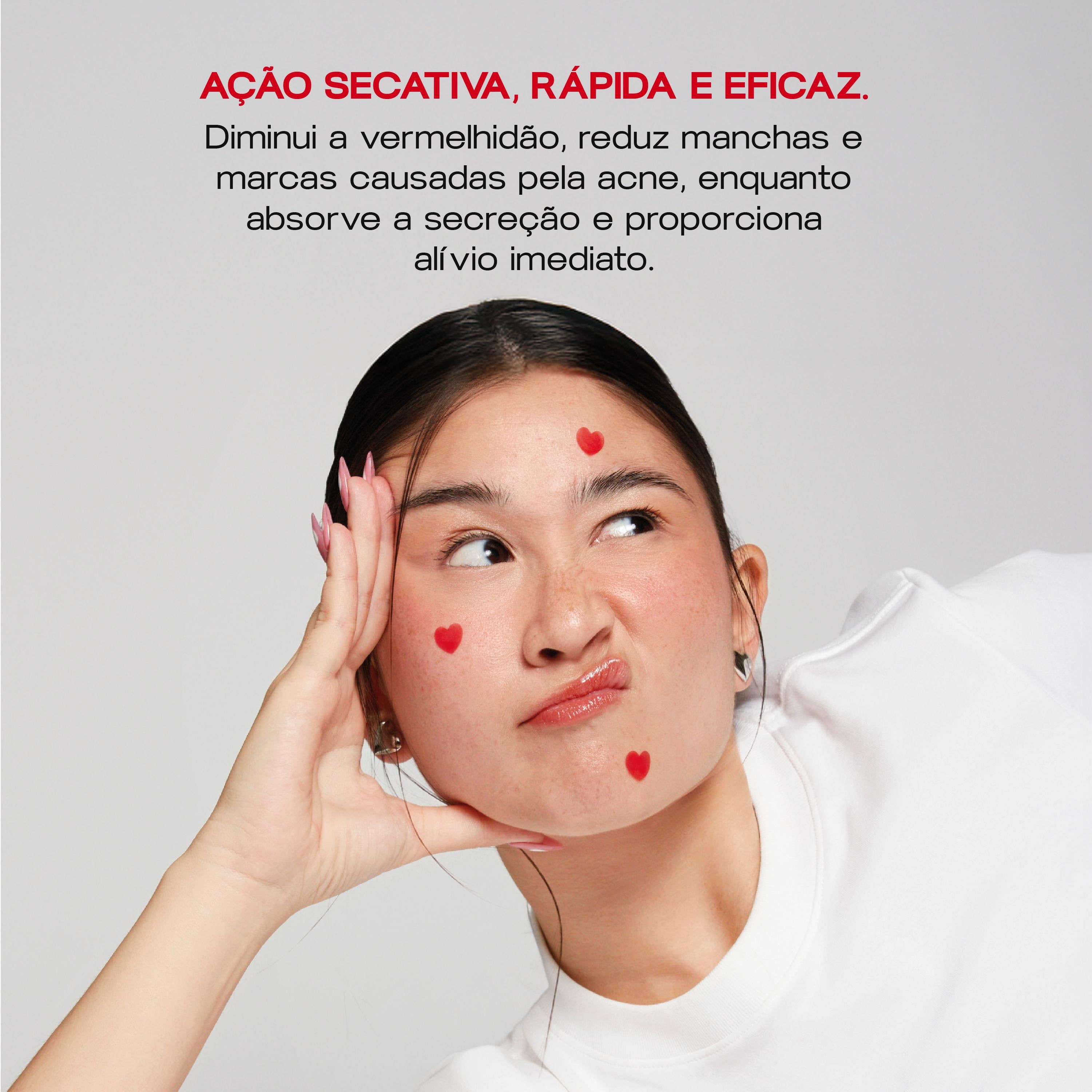 Adesivos Secativos para Espinhas - Bye Bye Acne